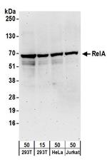 RelA Antibody in Western Blot (WB)