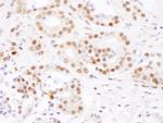 SF3B4 Antibody in Immunohistochemistry (Paraffin) (IHC (P))