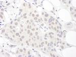 Sm-D3 Antibody in Immunohistochemistry (Paraffin) (IHC (P))