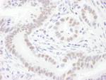 Sm-D3 Antibody in Immunohistochemistry (Paraffin) (IHC (P))