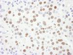 Sm-D3 Antibody in Immunohistochemistry (Paraffin) (IHC (P))