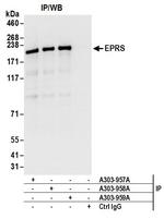 EPRS Antibody in Immunoprecipitation (IP)