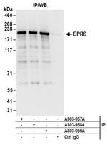 EPRS Antibody in Immunoprecipitation (IP)