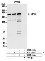 EPRS Antibody in Immunoprecipitation (IP)