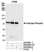 Androgen Receptor Antibody in Immunoprecipitation (IP)