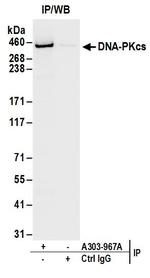 DNA-PKcs Antibody in Immunoprecipitation (IP)