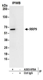 RRP9 Antibody in Immunoprecipitation (IP)