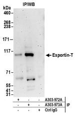 Exportin-T Antibody in Immunoprecipitation (IP)