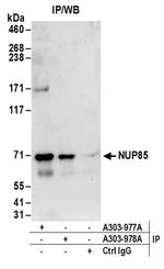 NUP85 Antibody in Immunoprecipitation (IP)