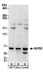 NUP85 Antibody in Western Blot (WB)