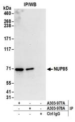 NUP85 Antibody in Immunoprecipitation (IP)