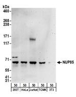 NUP85 Antibody in Western Blot (WB)