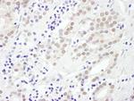 EXOSC10 Antibody in Immunohistochemistry (Paraffin) (IHC (P))