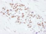 Mre11 Antibody in Immunohistochemistry (Paraffin) (IHC (P))