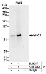 Mre11 Antibody in Immunoprecipitation (IP)