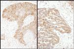 TS Antibody in Immunohistochemistry (Paraffin) (IHC (P))