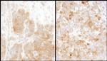 TS Antibody in Immunohistochemistry (Paraffin) (IHC (P))