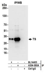 TS Antibody in Immunoprecipitation (IP)