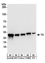 TS Antibody in Western Blot (WB)