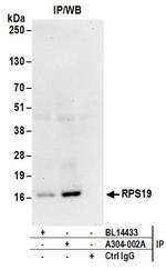 RPS19 Antibody in Immunoprecipitation (IP)