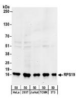 RPS19 Antibody in Western Blot (WB)