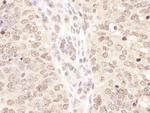 TCEB2 Antibody in Immunohistochemistry (Paraffin) (IHC (P))