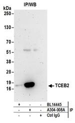 TCEB2 Antibody in Immunoprecipitation (IP)