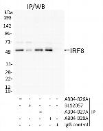 IRF8 Antibody in Immunoprecipitation (IP)