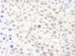 NHP2L1 Antibody in Immunohistochemistry (Paraffin) (IHC (P))