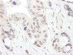 NHP2L1 Antibody in Immunohistochemistry (Paraffin) (IHC (P))