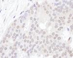 ZAP3 Antibody in Immunohistochemistry (Paraffin) (IHC (P))