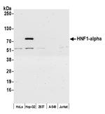 HNF1-alpha Antibody in Western Blot (WB)