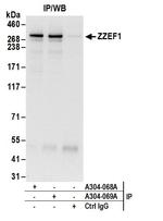 ZZEF1 Antibody in Immunoprecipitation (IP)