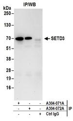 SETD3 Antibody in Immunoprecipitation (IP)