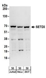 SETD3 Antibody in Western Blot (WB)