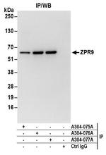 ZPR9 Antibody in Immunoprecipitation (IP)