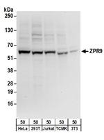 ZPR9 Antibody in Western Blot (WB)