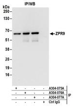 ZPR9 Antibody in Immunoprecipitation (IP)