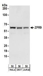 ZPR9 Antibody in Western Blot (WB)