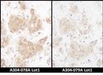 WWOX Antibody in Immunohistochemistry (Paraffin) (IHC (P))