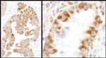 IDH2 Antibody in Immunohistochemistry (Paraffin) (IHC (P))