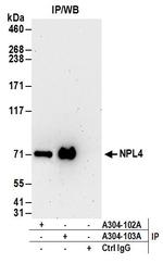 NPL4 Antibody in Immunoprecipitation (IP)