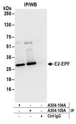 E2-EPF Antibody in Immunoprecipitation (IP)