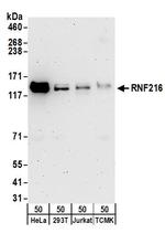 RNF216 Antibody in Western Blot (WB)