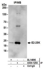 E2-25K Antibody in Immunoprecipitation (IP)