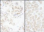 c-Myb Antibody in Immunohistochemistry (Paraffin) (IHC (P))