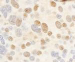 c-Myb Antibody in Immunohistochemistry (Paraffin) (IHC (P))