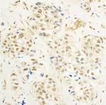 c-Myb Antibody in Immunohistochemistry (Paraffin) (IHC (P))