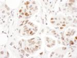 Phospho-SMC1 (Ser957) Antibody in Immunohistochemistry (Paraffin) (IHC (P))