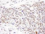 Phospho-SMC1 (Ser957) Antibody in Immunohistochemistry (Paraffin) (IHC (P))